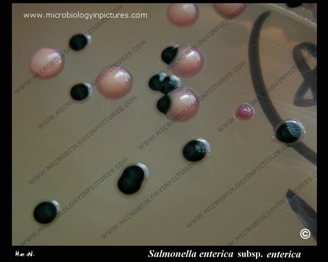 salmonella on desoxycholate citrate agar